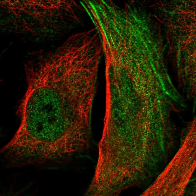 PSMD1 Antibody in Immunocytochemistry (ICC/IF)