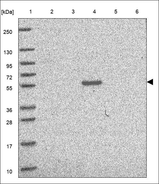 FCAMR Antibody in Western Blot (WB)