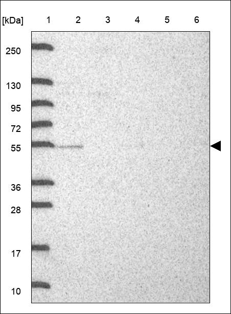 RAR gamma-1 Antibody in Western Blot (WB)