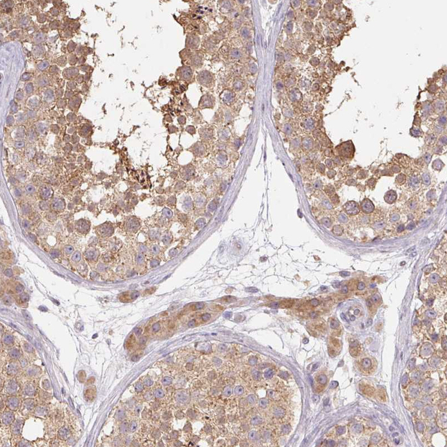 RAB11A Antibody in Immunohistochemistry (Paraffin) (IHC (P))