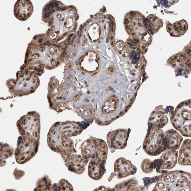 AKT3 Antibody in Immunohistochemistry (Paraffin) (IHC (P))