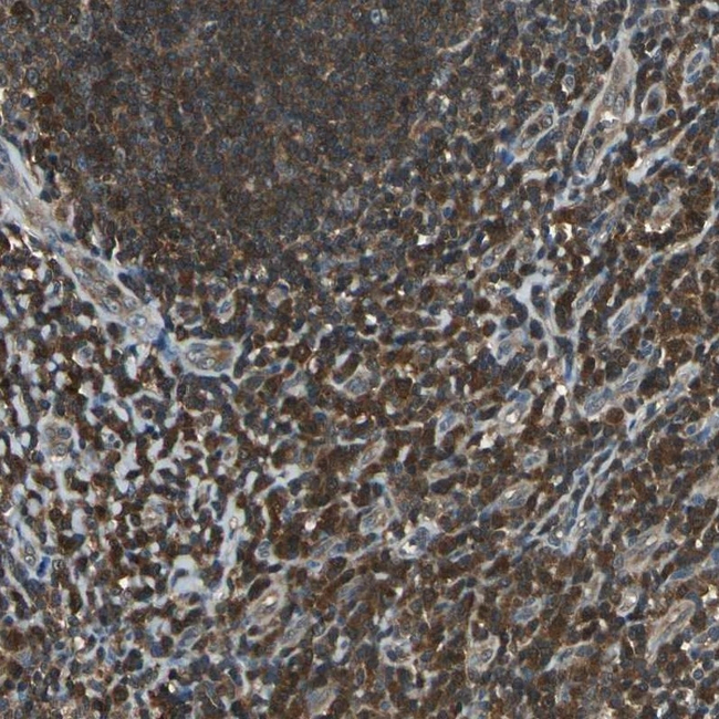 PSME1 Antibody in Immunohistochemistry (Paraffin) (IHC (P))