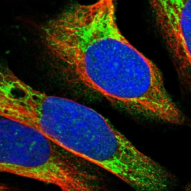 TRAF6 Antibody in Immunocytochemistry (ICC/IF)