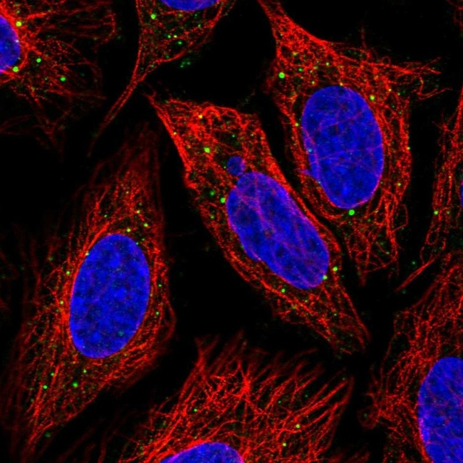 IRAK-M Antibody in Immunocytochemistry (ICC/IF)