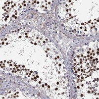 LOC81691 Antibody in Immunohistochemistry (Paraffin) (IHC (P))