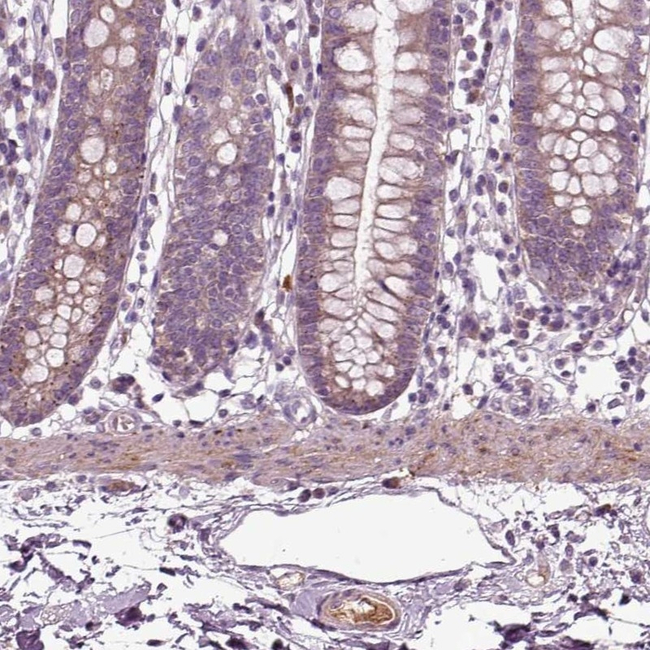 SPON1 Antibody in Immunohistochemistry (Paraffin) (IHC (P))