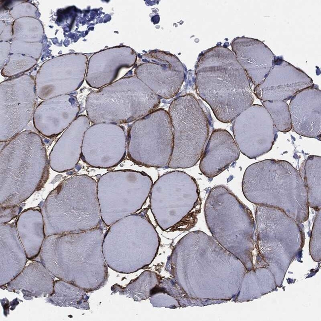 Caveolin 3 Antibody in Immunohistochemistry (Paraffin) (IHC (P))