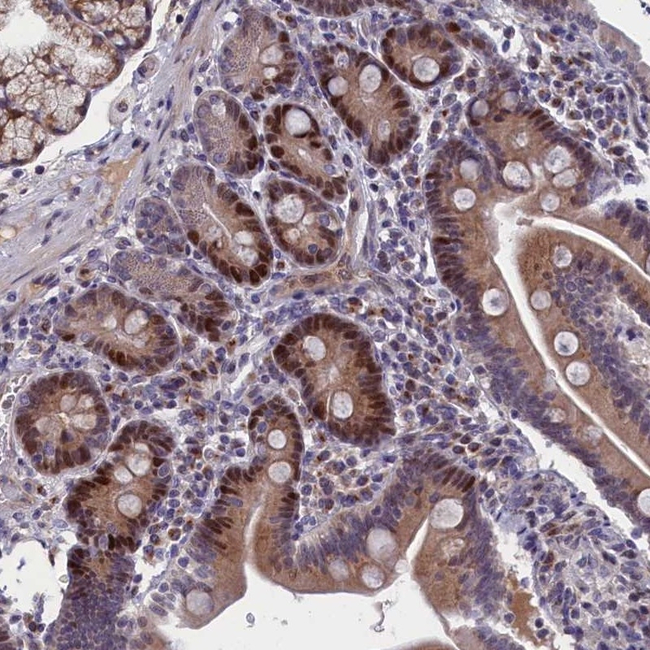 DNA Ligase I Antibody in Immunohistochemistry (Paraffin) (IHC (P))