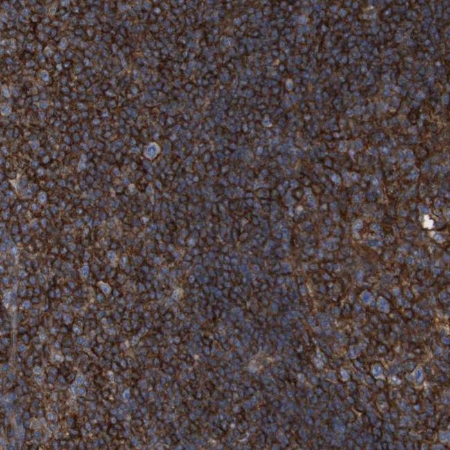 CCR6 Antibody in Immunohistochemistry (Paraffin) (IHC (P))