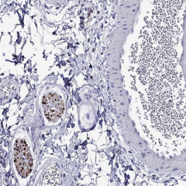 MPZ Antibody in Immunohistochemistry (Paraffin) (IHC (P))