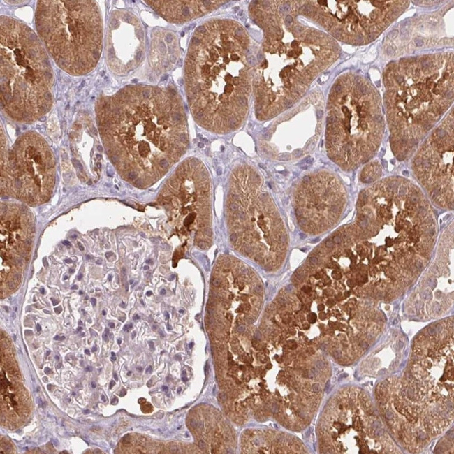 Cyclophilin A Antibody in Immunohistochemistry (Paraffin) (IHC (P))