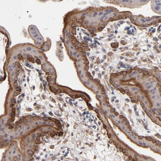 ITGB5 Antibody in Immunohistochemistry (Paraffin) (IHC (P))