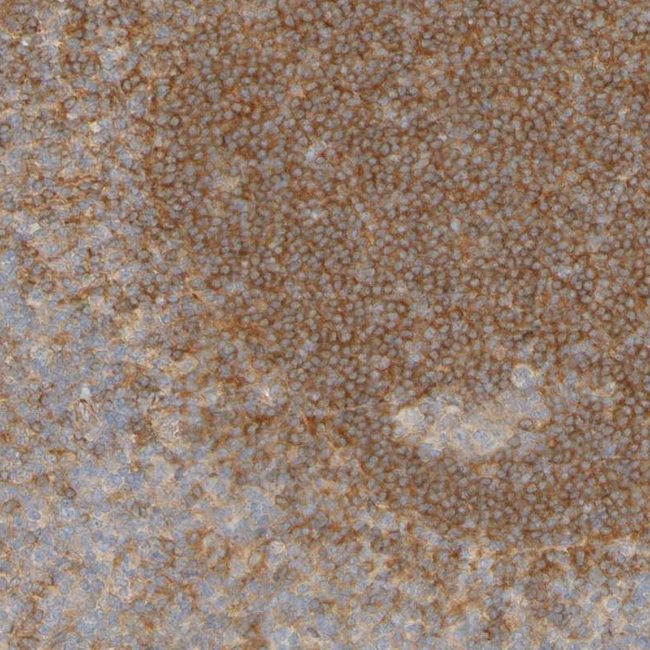 APPL1 Antibody in Immunohistochemistry (Paraffin) (IHC (P))