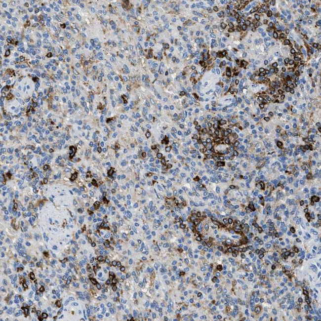 CD226 Antibody in Immunohistochemistry (Paraffin) (IHC (P))