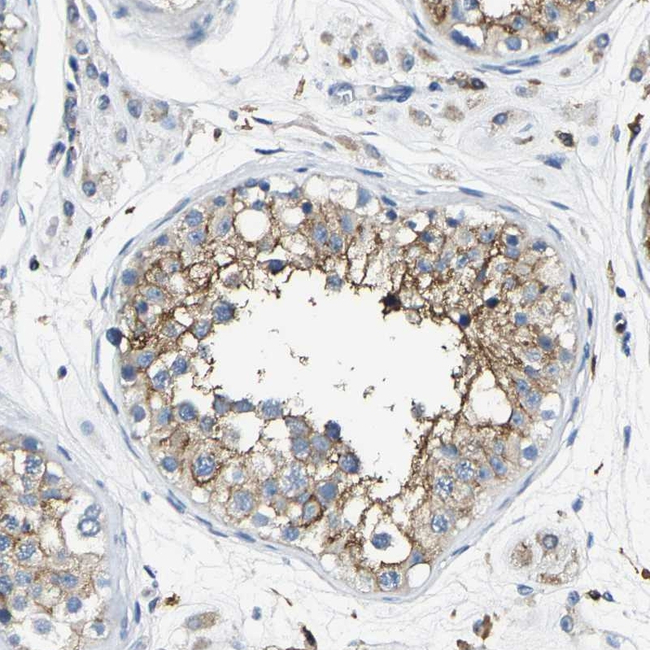 TRAF6 Antibody in Immunohistochemistry (Paraffin) (IHC (P))