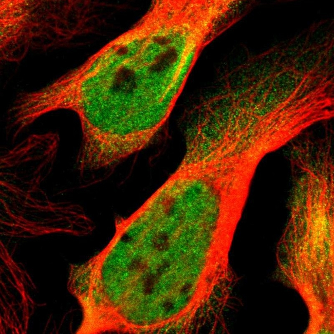 p300 Antibody in Immunocytochemistry (ICC/IF)