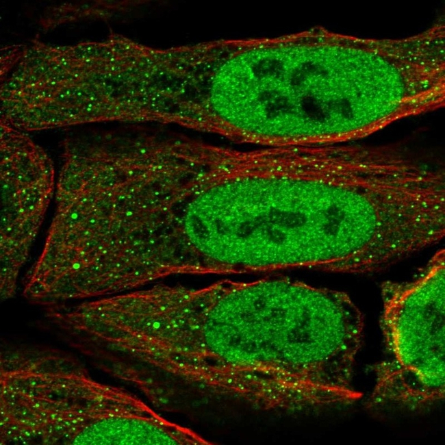 PAX5 Antibody in Immunocytochemistry (ICC/IF)
