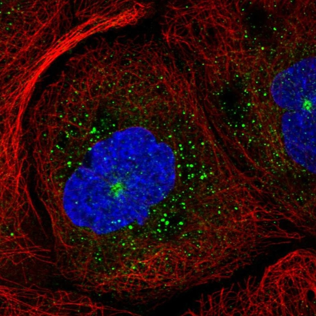 RAB11B Antibody in Immunocytochemistry (ICC/IF)