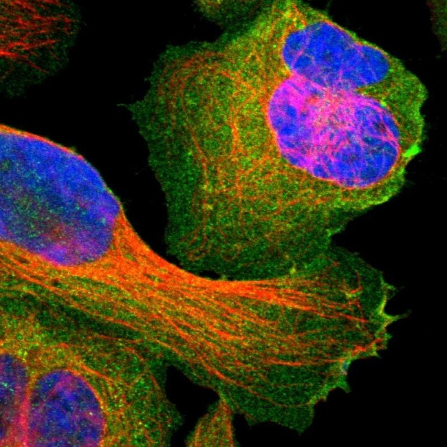 SNAP23 Antibody in Immunocytochemistry (ICC/IF)