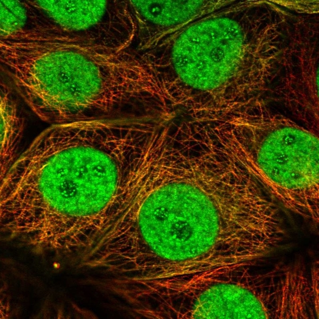 ESRRA Antibody in Immunocytochemistry (ICC/IF)