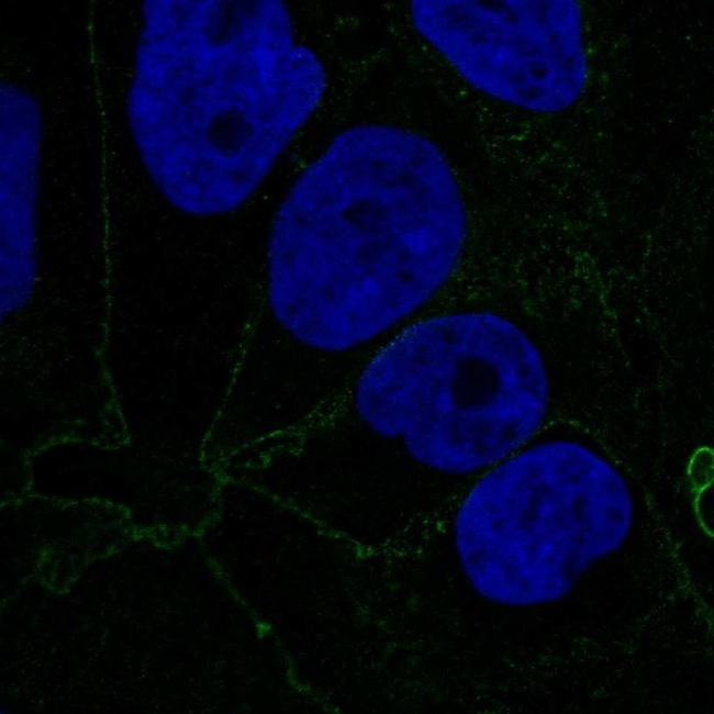 Catenin alpha-1 Antibody in Immunocytochemistry (ICC/IF)
