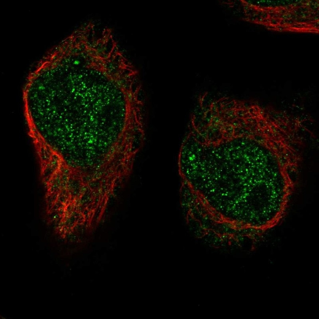 XRCC3 Antibody in Immunocytochemistry (ICC/IF)