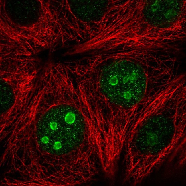 SETD7 Antibody in Immunocytochemistry (ICC/IF)