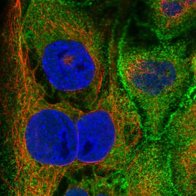 Villin Antibody in Immunocytochemistry (ICC/IF)