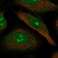 RIP140 Antibody in Immunocytochemistry (ICC/IF)