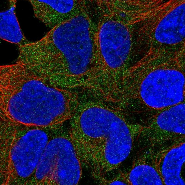 CaMKI Antibody in Immunocytochemistry (ICC/IF)