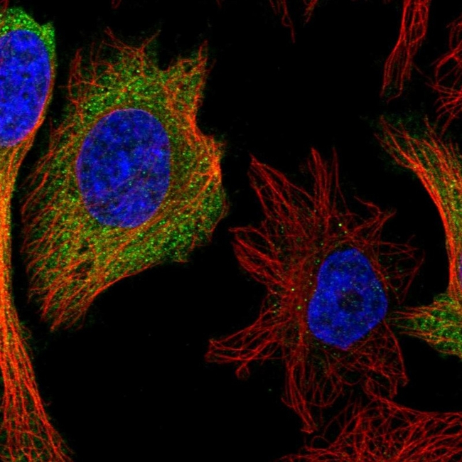 IFIT1 Antibody in Immunocytochemistry (ICC/IF)