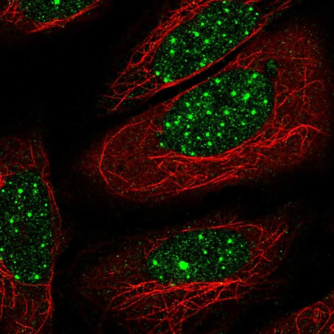 THRB Antibody in Immunocytochemistry (ICC/IF)