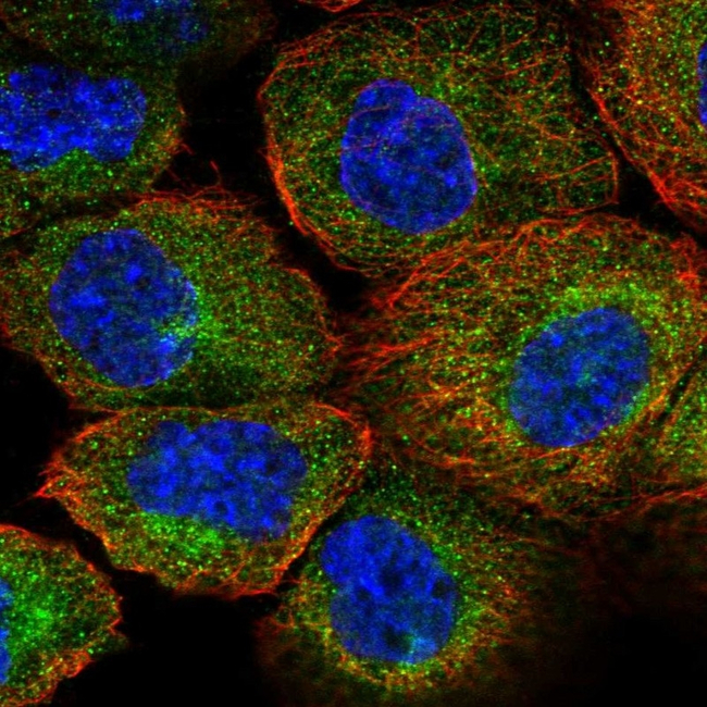 AIP Antibody in Immunocytochemistry (ICC/IF)