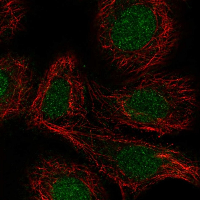 RARA Antibody in Immunocytochemistry (ICC/IF)