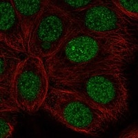 RARA Antibody in Immunocytochemistry (ICC/IF)