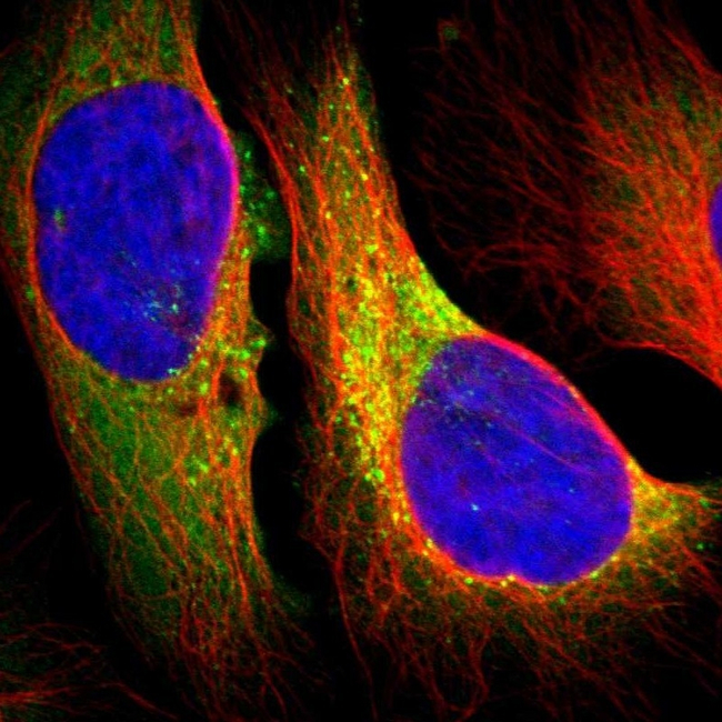 COL1A1 Antibody in Immunocytochemistry (ICC/IF)