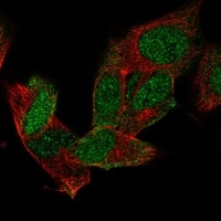 MSI1 Antibody in Immunocytochemistry (ICC/IF)