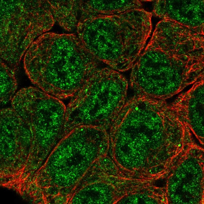 HIF-2 alpha Antibody in Immunocytochemistry (ICC/IF)