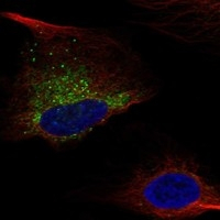 COL1A1 Antibody in Immunocytochemistry (ICC/IF)