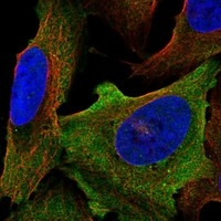 SCN8A Antibody in Immunocytochemistry (ICC/IF)