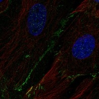 SCN8A Antibody in Immunocytochemistry (ICC/IF)