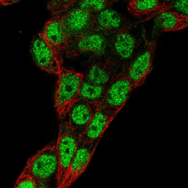 PROX1 Antibody in Immunocytochemistry (ICC/IF)