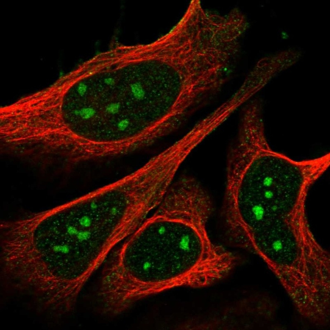 NPR1 Antibody in Immunocytochemistry (ICC/IF)