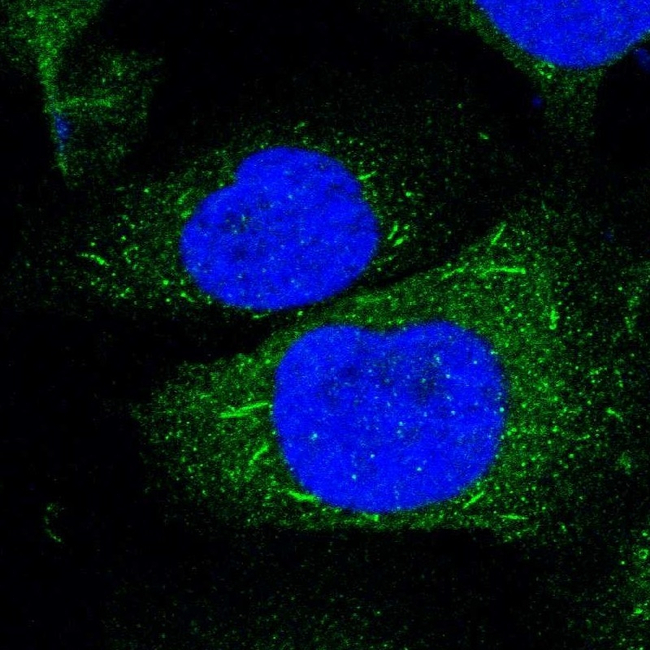 TNFRSF14 Antibody in Immunocytochemistry (ICC/IF)
