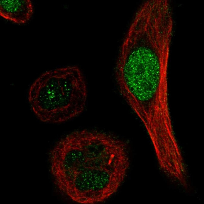 XRCC3 Antibody in Immunocytochemistry (ICC/IF)