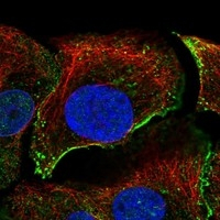 Dystroglycan Antibody in Immunocytochemistry (ICC/IF)