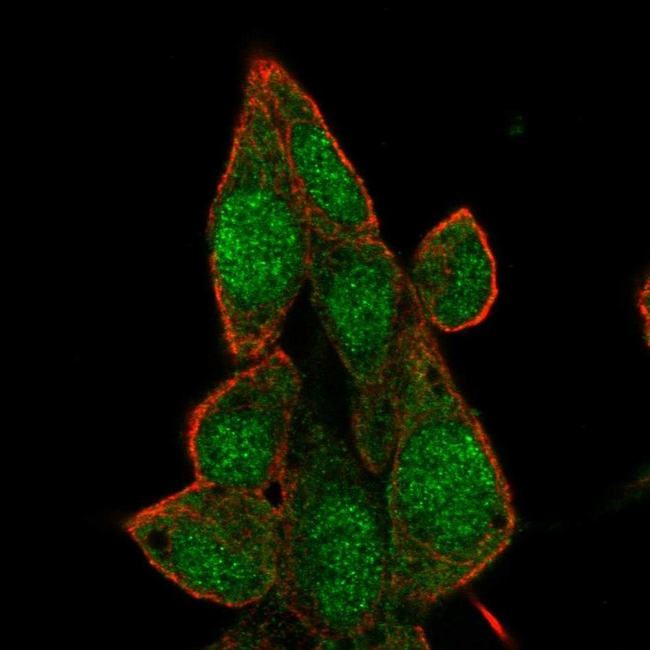 BRD7 Antibody in Immunocytochemistry (ICC/IF)