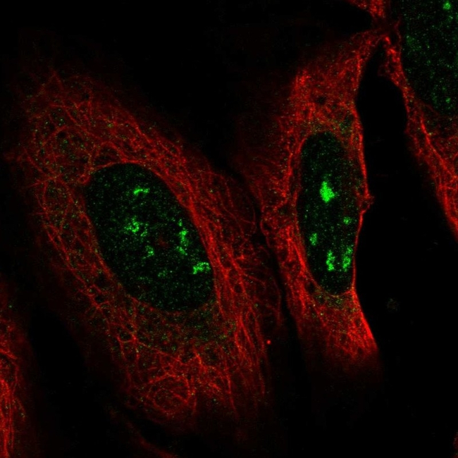 PAX2 Antibody in Immunocytochemistry (ICC/IF)
