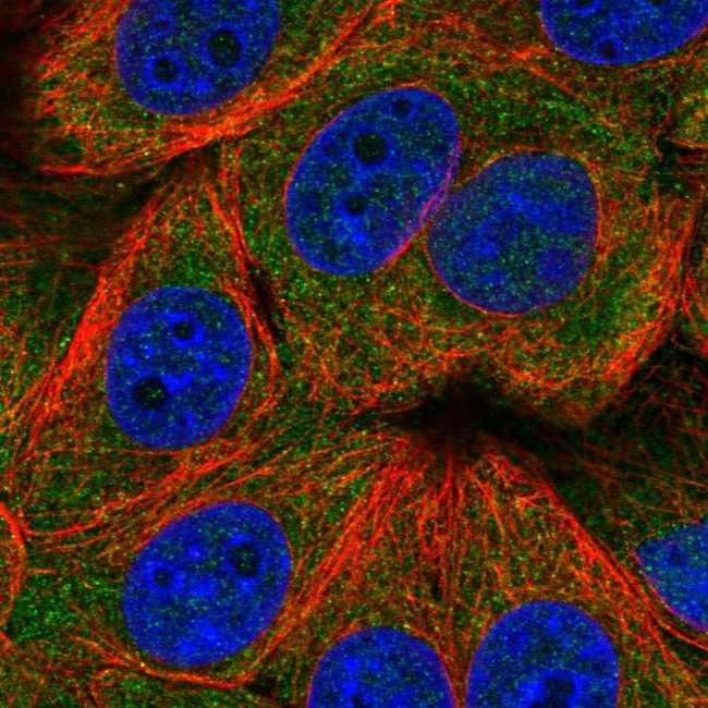 TIGAR Antibody in Immunocytochemistry (ICC/IF)