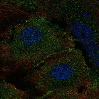 MLKL Antibody in Immunocytochemistry (ICC/IF)